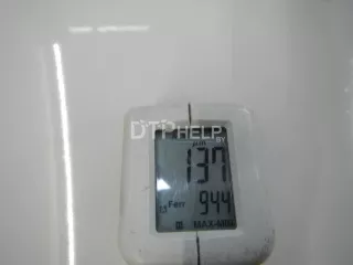 41617153940 Капот BMW 3 E90/E91/E92/E93 Арт AM70605679, вид 4